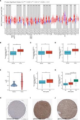 Frontiers Deciphering The Role Of Qpctl In Glioma Progression And